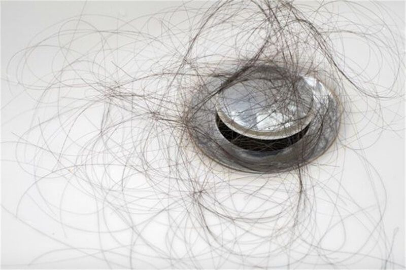 hair loss