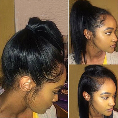 lace frontal