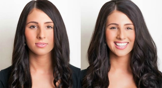 get thicker hair before and after
