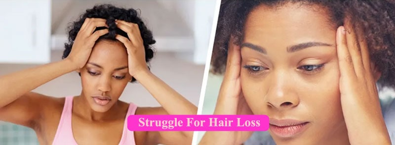 struggle for hair loss